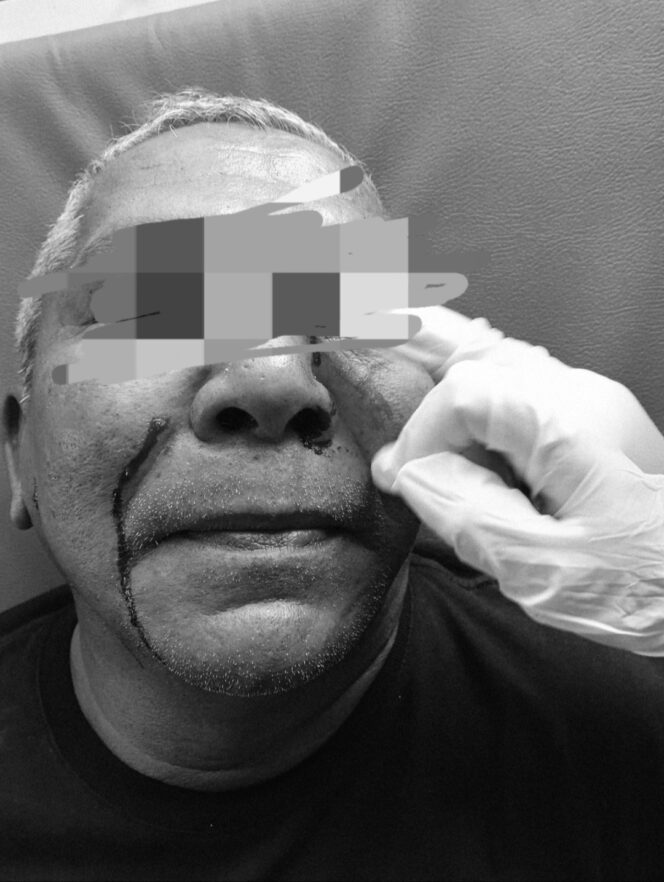 
					Foto: Kondisi Geuchik Amri Saini Pasca Kejadian